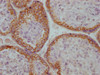 IHC image of CSB-MA196808 diluted at 1:100 and staining in paraffin-embedded human placenta tissue performed on a Leica BondTM system. After dewaxing and hydration, antigen retrieval was mediated by high pressure in a citrate buffer (pH 6.0) . Section was blocked with 10% normal goat serum 30min at RT. Then primary antibody (1% BSA) was incubated at 4°C overnight. The primary is detected by a Goat anti-mouse IgG polymer labeled by HRP and visualized using 0.05% DAB.