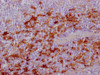 IHC image of CSB-MA179751 diluted at 1:100 and staining in paraffin-embedded human tonsil tissue performed on a Leica BondTM system. After dewaxing and hydration, antigen retrieval was mediated by high pressure in a citrate buffer (pH 6.0) . Section was blocked with 10% normal goat serum 30min at RT. Then primary antibody (1% BSA) was incubated at 4°C overnight. The primary is detected by a Goat anti-mouse IgG polymer labeled by HRP and visualized using 0.05% DAB.