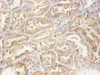 Immunohistochemical of paraffin-embedded human nephridial tissue using CSB-MA070501A0m at dilution of 1:200
