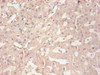 Immunohistochemical of paraffin-embedded human liver tissue using CSB-MA114091A0m at dilution of 1:200