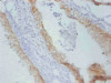 Immunohistochemistry of paraffin-embedded Rat prostate cancer using CSB-MA167191A0m at dilution of 1:100.