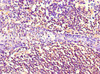 Immunohistochemistry of paraffin-embedded human tonsil tissue using CSB-MA0157131A0m at dilution of 1:100