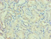 Immunohistochemical of paraffin-embedded human kidney tissue using CSB-MA089171A0m at dilution of 1:200.