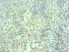 Immunohistochemical of paraffin-embedded human spleen tissue using CSB-MA0206421A0m at dilution of 1:200