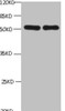 All lanes: Chromogranin-A transfected E.coli lysate<br />
 lane 1:Mouse Anti-6*his monoclonal antibody at 1ug/ml<br />
 lane 2 : Mouse anti- Chromogranin-A monoclonal antibody at 1ug/ml<br />
 Predicted band size : 52Kd<br />
 Observed band size : 52kd<br />