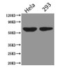 Western Blot<br />
 Positive WB detected in: Hela whole cell lysate, HEK293 whole cell lysate<br />
 All lanes: PODXL antibody at 2.5µg/ml<br />
 Secondary<br />
 Goat polyclonal to Mouse IgG at 1/5000 dilution<br />
 Predicted band size: 59, 56 kDa<br />
 Observed band size: 59 kDa<br />