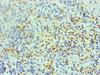 Immunohistochemical of paraffin-embedded human spleen using CSB-MA0206411A0m at dilution of 1:200