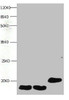 All lanes: Mouse anti- Human Fatty acid-binding protein monoclonal antibody at 1ug/ml<br />
 Lane 1:mouse heart muscle lysate<br />
 Lane 2:rat heart muscle lysate<br />
 Lane 3:FABP3 transfected SF9 cell lysate<br />
 Predicted band size : 15kd<br />
 Observed band size : 15kd<br />