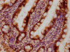 Immunohistochemical of paraffin-embedded human small intestinal tissue using CSB-MA0128871A0m at dilution of 1:100