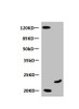 Western Blot<br />
 All lanes: Mouse anti-Human Myoglobin monoclonal antibody at 0.3µg/ml<br />
 Lane 1: Mouse heart muscle lysate<br />
 Lane 2: Recombinant Myoglobin at 10µg<br />
 Secondary HRP labeled Goat polyclonal to Mouse IgG at 1/3000 dilution<br />
 Predicted band size: 18 kDa<br />
 Observed band size: 20 kDa<br />
 Additional bands at: 120 kDa<br />