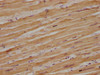 Immunohistochemical of paraffin-embedded human heart tissue using CSB-MA079101A0m at dilution of 1:100