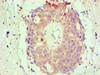 Immunohistochemical of paraffin-embedded Human endometrium tissue using CSB-MA0026131A0m at dilution of 1:200