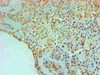 Immunohistochemical of paraffin-embedded Human Breast tissue using CSB-MA0234621A0m at dilution of 1:200.