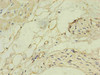 Immunohistochemistry of paraffin-embedded human heart using CSB-MA168602A0m in 30ug/ml dilute concentrations.