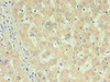 Immunohistochemistry of paraffin-embedded human liver using CSB-MA027412E0m in 30ug/ml dilute concentrations.