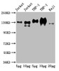 Western Blot<br />
 Positive WB detected in: Jurkat whole cell lysate, THP-1 whole cell lysate, Raji whole cell lysate<br />
 All lanes: CD31 antibody at 2.5µg/ml<br />
 Secondary<br />
 Goat polyclonal to Mouse IgG at 1/50000 dilution<br />
 Predicted band size: 83, 81, 80, 82 kDa<br />
 Observed band size: 130 kDa<br />