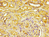 IHC image of CSB-MA017767A0m diluted at 1:100 and staining in paraffin-embedded human kidney tissue performed on a Leica BondTM system. After dewaxing and hydration, antigen retrieval was mediated by high pressure in a citrate buffer (pH 6.0) . Section was blocked with 10% normal goat serum 30min at RT. Then primary antibody (1% BSA) was incubated at 4°C overnight. The primary is detected by a biotinylated secondary antibody and visualized using an HRP conjugated SP system.
