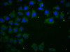 Immunofluorescence staining of Hela cells with CSB-MA005034A0m at 1:100, counter-stained with DAPI. The cells were blocked in 10% normal Goat Serum and then incubated with the primary antibody overnight at 4°C. The secondary antibody was Alexa Fluor 488-congugated AffiniPure Goat Anti-Mouse IgG (H+L) .