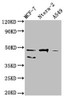 Western Blot<br />
 Positive WB detected in: MCF-7 whole cell lysate, Ntera-2 whole cell lysate, A549 whole cell lysate<br />
 All lanes: NANOG antibody at 1:500<br />
 Secondary<br />
 Goat polyclonal to Mouse IgG at 1/10000 dilution<br />
 Predicted band size: 35, 33 kDa<br />
 Observed band size: 46, 40 kDa<br />