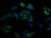 Immunofluorescence staining of Hela cells with CSB-MA004938A0m at 1:100, counter-stained with DAPI. The cells were blocked in 10% normal Goat Serum and then incubated with the primary antibody overnight at 4°C. The secondary antibody was Alexa Fluor 488-congugated AffiniPure Goat Anti-Mouse IgG (H+L) .