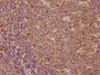 IHC image of CSB-MA878942A0m diluted at 1:100 and staining in paraffin-embedded human tonsil tissue performed on a Leica BondTM system. After dewaxing and hydration, antigen retrieval was mediated by high pressure in a citrate buffer (pH 6.0) . Section was blocked with 10% normal goat serum 30min at RT. Then primary antibody (1% BSA) was incubated at 4°C overnight. The primary is detected by a biotinylated secondary antibody and visualized using an HRP conjugated SP system.