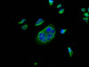 Immunofluorescence staining of Hela cells with CSB-MA878942A0m at 1:100, counter-stained with DAPI. The cells were blocked in 10% normal Goat Serum and then incubated with the primary antibody overnight at 4°C. The secondary antibody was Alexa Fluor 488-congugated AffiniPure Goat Anti-Mouse IgG (H+L) .