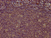 IHC image of CSB-MA878942A1m diluted at 1:100 and staining in paraffin-embedded human tonsil tissue performed on a Leica BondTM system. After dewaxing and hydration, antigen retrieval was mediated by high pressure in a citrate buffer (pH 6.0) . Section was blocked with 10% normal goat serum 30min at RT. Then primary antibody (1% BSA) was incubated at 4°C overnight. The primary is detected by a biotinylated secondary antibody and visualized using an HRP conjugated SP system.