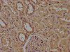 IHC image of CSB-MA004879A0m diluted at 1:100 and staining in paraffin-embedded human stomach tissue performed on a Leica BondTM system. After dewaxing and hydration, antigen retrieval was mediated by high pressure in a citrate buffer (pH 6.0) . Section was blocked with 10% normal goat serum 30min at RT. Then primary antibody (1% BSA) was incubated at 4°C overnight. The primary is detected by a biotinylated secondary antibody and visualized using an HRP conjugated SP system.