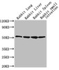 Western Blot<br />
 Positive WB detected in: Rabbit lung tissue, Rabbit liver tissue, Rabbit spleen tissue, Rabbit small intestine tissue<br />
 All lanes: CD14 antibody at 1:2500<br />
 Secondary<br />
 Goat polyclonal to Mouse IgG at 1/10000 dilution<br />
 Predicted band size: 41 kDa<br />
 Observed band size: 55 kDa<br />