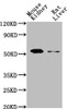 Western Blot<br />
 Positive WB detected in: Mouse kidney tissue, Rat liver tissue<br />
 All lanes: CD14 antibody at 1:2000<br />
 Secondary<br />
 Goat polyclonal to Mouse IgG at 1/10000 dilution<br />
 Predicted band size: 41 kDa<br />
 Observed band size: 55 kDa<br />