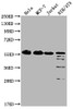 Western Blot<br />
 Positive WB detected in: Hela whole cell lysate, MCF-7 whole cell lysate, Jurkat whole cell lysate, NIH/3T3 whole cell lysate<br />
 All lanes: PKM antibody at 1:1000<br />
 Secondary<br />
 Goat polyclonal to Mouse IgG at 1/10000 dilution<br />
 Predicted band size: 58 kDa<br />
 Observed band size: 58 KDa<br />
 Exposure time: 1min
