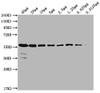 Western Blot<br />
 Positive WB detected in: MCF-7 whole cell lysate at 40µg, 20µg, 10µg, 5µg, 2.5µg, 1.25µg, 0.625µg, 0.3125µg<br />
 All lanes: PKM antibody at 1:1000<br />
 Secondary<br />
 Goat polyclonal to Mouse IgG at 1/10000 dilution<br />
 Predicted band size: 58 kDa<br />
 Observed band size: 58 KDa<br />
 Exposure time: 5min