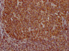 IHC image of CSB-MA018072A0m diluted at 1:400 and staining in paraffin-embedded human tonsil tissue performed on a Leica BondTM system. After dewaxing and hydration, antigen retrieval was mediated by high pressure in a citrate buffer (pH 6.0) . Section was blocked with 10% normal goat serum 30min at RT. Then primary antibody (1% BSA) was incubated at 4°C overnight. The primary is detected by a biotinylated secondary antibody and visualized using an HRP conjugated SP system.