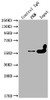 Immunoprecipitating PKM in Hela whole cell lysate<br />
 Lane 1: Mouse control IgG (1µg) instead of CSB-MA018072A0m in Hela whole cell lysate. For western blotting, a HRP-conjugated Protein G antibody was used as the secondary antibody (1/2000) <br />
 Lane 2: CSB-MA018072A0m (5µg) + Hela whole cell lysate (500µg) <br />
 Lane 3: Hela whole cell lysate (10µg) <br />