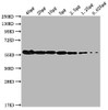 Western Blot<br />
 Positive WB detected in: MCF-7 whole cell lysate at 40µg, 20µg, 10µg, 5µg, 2.5µg, 1.25µg, 0.625µg<br />
 All lanes: PKM antibody at 1:1000<br />
 Secondary<br />
 Goat polyclonal to Mouse IgG at 1/10000 dilution<br />
 Predicted band size: 58 kDa<br />
 Observed band size: 58 KDa<br />
 Exposure time: 5min