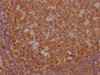 IHC image of CSB-MA018072A1m diluted at 1:1000 and staining in paraffin-embedded human tonsil tissue performed on a Leica BondTM system. After dewaxing and hydration, antigen retrieval was mediated by high pressure in a citrate buffer (pH 6.0) . Section was blocked with 10% normal goat serum 30min at RT. Then primary antibody (1% BSA) was incubated at 4°C overnight. The primary is detected by a biotinylated secondary antibody and visualized using an HRP conjugated SP system.