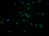 Immunofluorescence staining of MCF-7 cells with CSB-MA007670A0m at 1:270, counter-stained with DAPI. The cells were blocked in 10% normal Goat Serum and then incubated with the primary antibody overnight at 4°C. The secondary antibody was Alexa Fluor 488-congugated AffiniPure Goat Anti-Mouse IgG (H+L) .