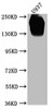 Western Blot<br />