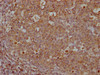 IHC image of CSB-MA019049A0m diluted at 1:500 and staining in paraffin-embedded human tonsil tissue performed on a Leica BondTM system. After dewaxing and hydration, antigen retrieval was mediated by high pressure in a citrate buffer (pH 6.0) . Section was blocked with 10% normal goat serum 30min at RT. Then primary antibody (1% BSA) was incubated at 4°C overnight. The primary is detected by a Goat anti-rabbit IgG labeled by HRP and visualized using 0.05% DAB.
