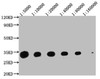 Western Blot<br />
 Positive WB detected in: Hela whole cell lysate at 20μg, 10μg, 5μg, 2.5μg, 1.25μg, 0.625μg
 All lanes: YWHAZ antibody at 1:5000<br />
 Secondary<br />
 Goat polyclonal to mouse IgG at 1/50000 dilution<br />
 Predicted band size: 34 KDa<br />
 Observed band size: 34 KDa<br />
 Exposure time：5min