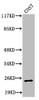 Western Blot analysis of COS7 cells using Cleaved-Integrin α7 LC (E959) Polyclonal Antibody Western Blot analysis of COS7 cells using Cleaved-Integrin α7 LC (E959) Polyclonal Antibody