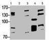 Western blot analysis of 1) Hela, 2) Jurkat, 3) HepG2, 4) Mouse Liver tissue, 5) Rat Brain tissue, diluted at 1:2000.