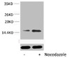 Western blot analysis of extracts from Hela cells, untreated (-) or treated, 1:5000.