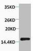 Western blot analysis of extracts from Hela cells, 1:2000.