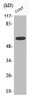 Western Blot analysis of COS7 cells using Phospho-Chk2 (S516) Polyclonal Antibody