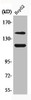 Western Blot analysis of HepG2 cells using Phospho-c-Kit (Y721) Polyclonal Antibody