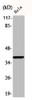 Western Blot analysis of HeLa cells using Phospho-MEK-3 (S218) Polyclonal Antibody