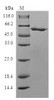 (Tris-Glycine gel) Discontinuous SDS-PAGE (reduced) with 5% enrichment gel and 15% separation gel.