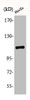 Western Blot analysis of HuvEc cells using Phospho-Rb (S807) Polyclonal Antibody