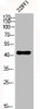 Western Blot analysis of 22RV1 cells using Phospho-c-Fos (S32) Polyclonal Antibody